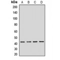 LifeSab™ GRPR Rabbit pAb (50 µl)
