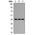 LifeSab™ Agmatinase Rabbit pAb (50 µl)
