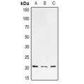 LifeSab™ H-Ras Rabbit pAb (50 µl)