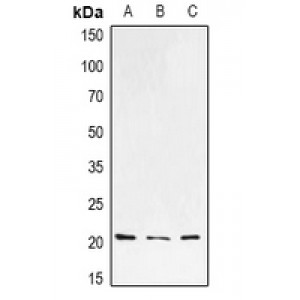LifeSab™ H-Ras Rabbit pAb (50 µl)