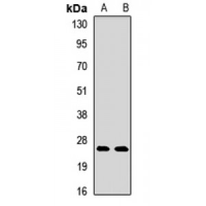 LifeSab™ Cystatin 8 Rabbit pAb (50 µl)