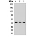 LifeSab™ PORCN Rabbit pAb (50 µl)