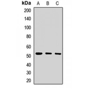 LifeSab™ PORCN Rabbit pAb (50 µl)