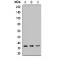 LifeSab™ CD138 Rabbit pAb (50 µl)