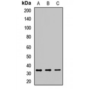 LifeSab™ CD138 Rabbit pAb (50 µl)