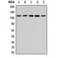 LifeSab™ Sec8 Rabbit pAb (50 µl)