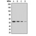 LifeSab™ MCT2 Rabbit pAb (50 µl)