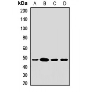 LifeSab™ ACADL Rabbit pAb (50 µl)