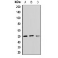 LifeSab™ LHX9 Rabbit pAb (50 µl)