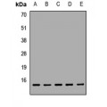 LifeSab™ UQCRB Rabbit pAb (50 µl)