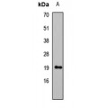 LifeSab™ Leptin Rabbit pAb (50 µl)