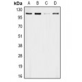 LifeSab™ APOB Rabbit pAb (50 µl)