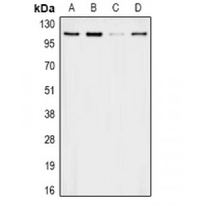 LifeSab™ APOB Rabbit pAb (50 µl)