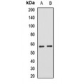 LifeSab™ FGB Rabbit pAb (50 µl)
