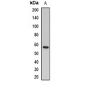 LifeSab™ MYOC Rabbit pAb (50 µl)