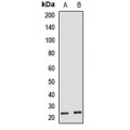 LifeSab™ HBEGF Rabbit pAb (50 µl)