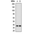 LifeSab™ GNB1 Rabbit pAb (50 µl)