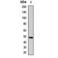 LifeSab™ uPA Rabbit pAb (50 µl)