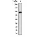 LifeSab™ ALIX Rabbit pAb (50 µl)
