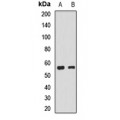 LifeSab™ EGLN2 Rabbit pAb (50 µl)
