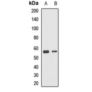 LifeSab™ DNAJC7 Rabbit pAb (50 µl)