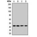 LifeSab™ BDKRB2 Rabbit pAb (50 µl)