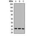 LifeSab™ Aquaporin 10 Rabbit pAb (50 µl)