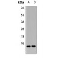 LifeSab™ RAMP2 Rabbit pAb (50 µl)