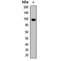 LifeSab™ NFAT1 Rabbit pAb (50 µl)