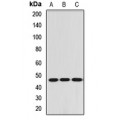 LifeSab™ RBM17 Rabbit pAb (50 µl)