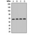 LifeSab™ ALDH6A1 Rabbit pAb (50 µl)