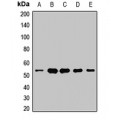 LifeSab™ UQCRC1 Rabbit pAb (50 µl)