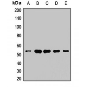 LifeSab™ UQCRC1 Rabbit pAb (50 µl)