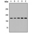 LifeSab™ RhoGAP5 Rabbit pAb (50 µl)
