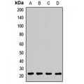 LifeSab™ ARF5 Rabbit pAb (50 µl)