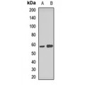 LifeSab™ ATP6V1B2 Rabbit pAb (50 µl)