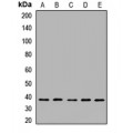 LifeSab™ CAPZA1 Rabbit pAb (50 µl)