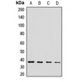 LifeSab™ CPOX Rabbit pAb (50 µl)