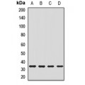 LifeSab™ CRYMRabbit pAb (50 µl)