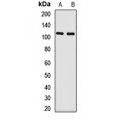LifeSab™ CYLD Rabbit pAb (50 µl)