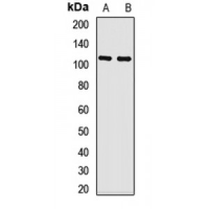 LifeSab™ CYLD Rabbit pAb (50 µl)