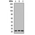 LifeSab™ GPx-7 Rabbit pAb (50 µl)