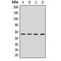 LifeSab™ HMGCS1 Rabbit pAb (50 µl)