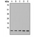 LifeSab™ NDUFA5 Rabbit pAb (50 µl)