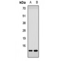 LifeSab™ NDUFS6 Rabbit pAb (50 µl)