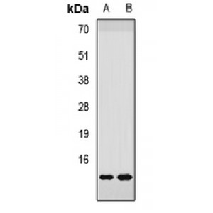 LifeSab™ NDUFS6 Rabbit pAb (50 µl)