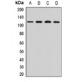 LifeSab™ OSBP Rabbit pAb (50 µl)