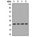 LifeSab™ PGAM1 Rabbit pAb (50 µl)