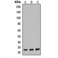 LifeSab™ PSMB6 Rabbit pAb (50 µl)