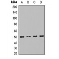 LifeSab™ RNH1 Rabbit pAb (50 µl)